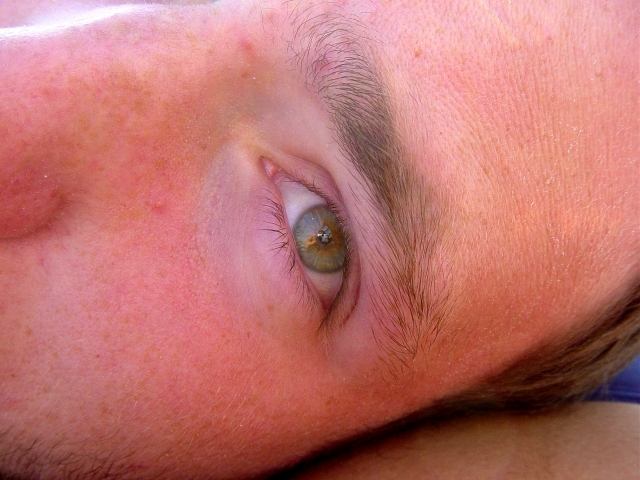 eye wide open