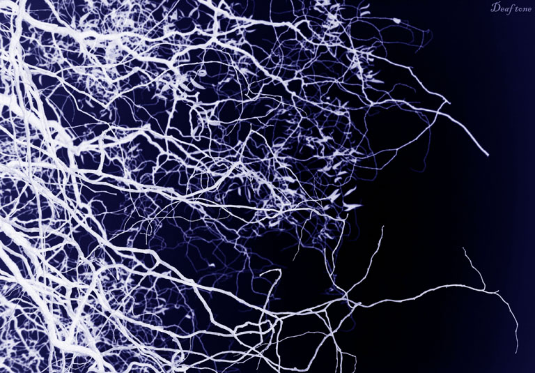 Autumn pt.11 [Natural electricity]