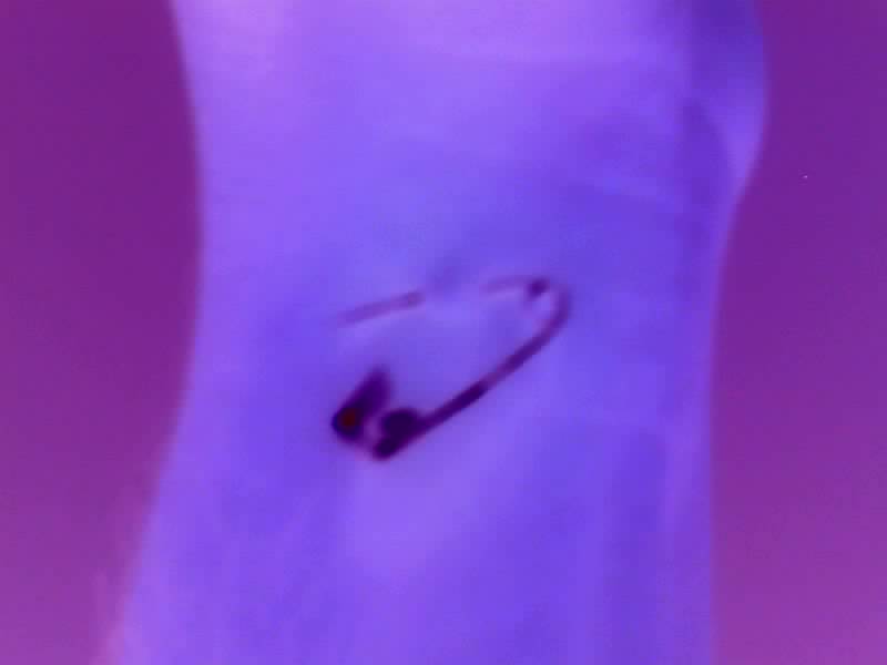 Hole