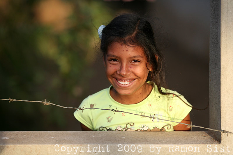 Bimba con Scarlattina (Nicaragua)