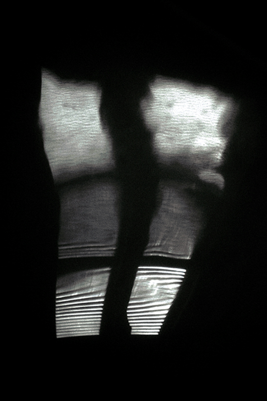 ecografia di una finestra