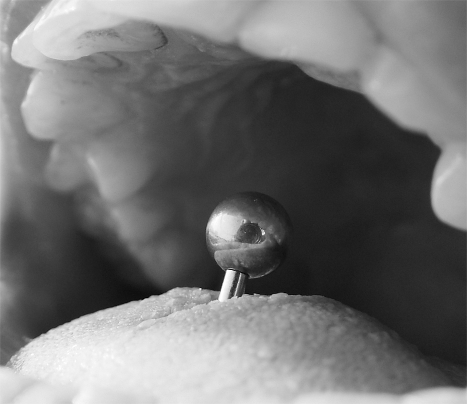 whats that on your tounge