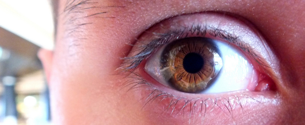 My Eye