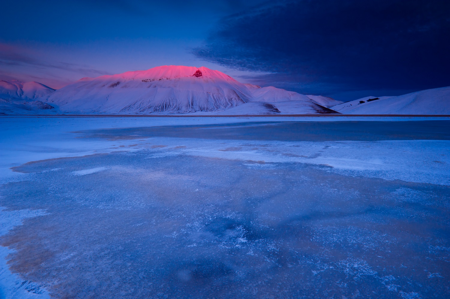 Wonder Castelluccio Stage IV