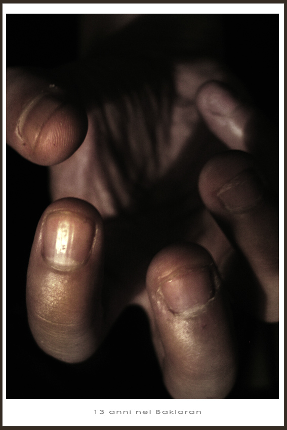 13 anni nel Baklaran