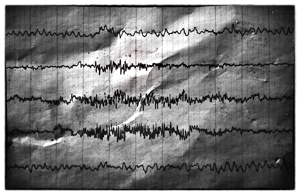 Elettroencefalogramma