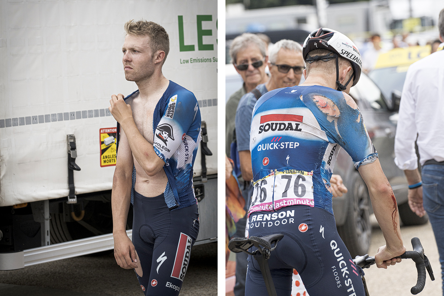 Tour de France...infortunio