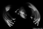 BiPoLaR DiSoRdEr BiPoLaR DiSoRdEr