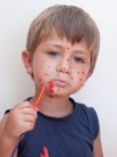 varicella varicella