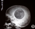 Licantropia Licantropia